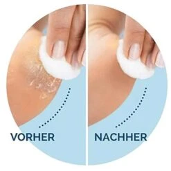 Scholl Ersatzrollen ExpertCare Wet&Dry, Stark, Für Hornhautentferner Velvet Smooth, 2 Stück 13 Scholl Ersatzrollen ExpertCare Wet&Dry, Stark, Für Hornhautentferner Velvet Smooth, 2 Stück -Küche Fach Geschäft d34b80a20eeb5525f778c3cca15c6c27de86a67f ersatzrollen scholl expertcare wetunddry stark